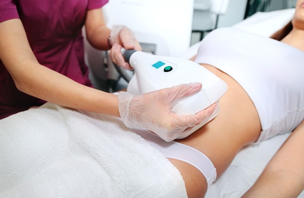 How Much to Tip for Coolsculpting